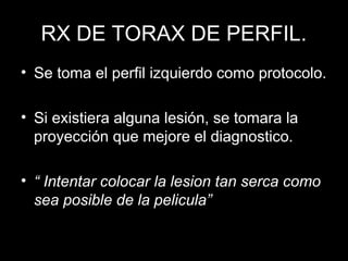 RX DE TORAX NORMAL y ...