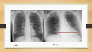 RX DE TORAX NORMAL-HISTORIA Y GENERALIDADES.pdf