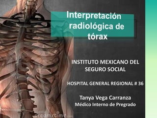 INSTITUTO MEXICANO DEL
SEGURO SOCIAL
HOSPITAL GENERAL REGIONAL # 36

Tanya Vega Carranza
Médico Interno de Pregrado

 