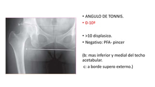 rx en cadera.pptx