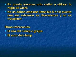    Rx puede tomarse orto radial o utilizar la
    regla de Clark
   No se deben emplear limas No 8 o 10 puesto
    que sus extremos se desvanecen y no se
    visualizan

Otras referencias:
 El asa del clamp o grapa

 El arco del clamp
 