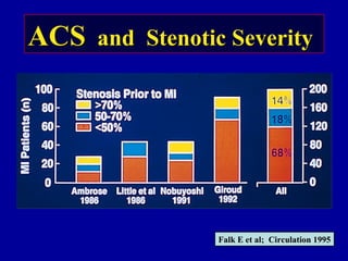 ACSACS and Stenotic Severityand Stenotic Severity
Falk E et al; Circulation 1995Falk E et al; Circulation 1995
 