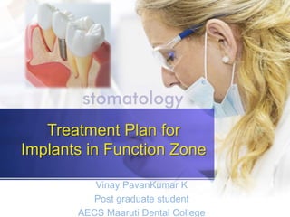 Treatment Plan for
Implants in Function Zone
Vinay PavanKumar K
Post graduate student
AECS Maaruti Dental College
 