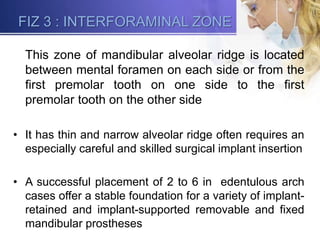 Treatment plan for Implants in funtional zone | PPTX