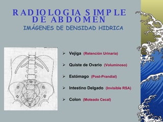 RADIOLOGIA SIMPLE DE ABDOMEN <ul><li>Vejiga  (Retención Urinaria) </li></ul><ul><li>Quiste de Ovario  (Voluminoso) </li></...