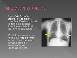 Rx simple de abdomen | PPTX