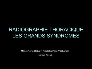 RADIOGRAPHIE THORACIQUE
LES GRANDS SYNDROMES
Marie-Pierre Debray, Nicoletta Pasi, Yaël Amar
Hôpital Bichat

 