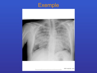 Exemple 