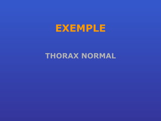 EXEMPLE THORAX NORMAL 
