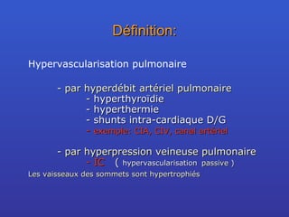 Définition: Hypervascularisation pulmonaire -  par hyperdébit artériel pulmonaire -  hyperthyroïdie - hyperthermie - shunts intra-cardiaque D/G  -  exemple: CIA, CIV, canal artériel - par hyperpression veineuse pulmonaire - IC (  hypervascularisation passive ) Les vaisseaux des sommets sont hypertrophiés 