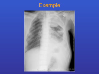 Exemple 