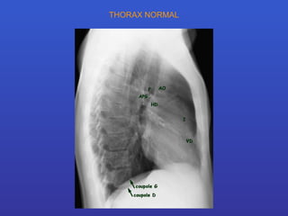 THORAX NORMAL 