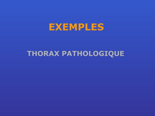 EXEMPLES THORAX PATHOLOGIQUE 