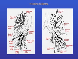 THORAX NORMAL 