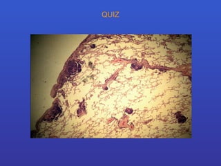 QUIZ 