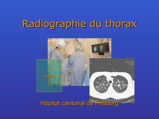 Radiographie du thorax thorax Hôpital cantonal de Fribourg 