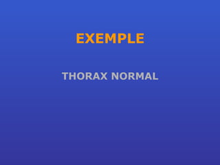 EXEMPLE THORAX NORMAL 