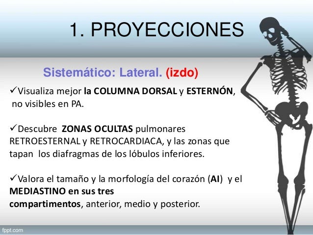 Lectura sistemática Rx Tórax Lectura sistemática Rx Tórax