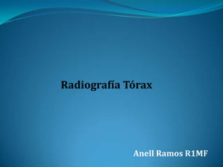Radiografía Tórax

Anell Ramos R1MF

 