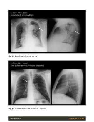 Rx torax | PDF