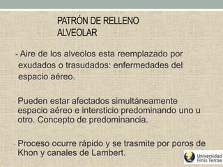 PATRÓN DE RELLENO
ALVEOLAR
- Aire de los alveolos esta reemplazado por
exudados o trasudados: enfermedades del
espacio aéreo.
- Pueden estar afectados simultáneamente
espacio aéreo e intersticio predominando uno u
otro. Concepto de predominancia.
- Proceso ocurre rápido y se trasmite por poros de
Khon y canales de Lambert.
 