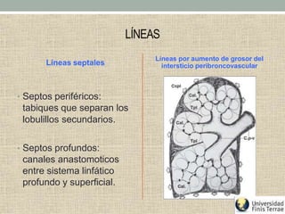 LÍNEAS
Líneas septales
• Septos periféricos:
tabiques que separan los
lobulillos secundarios.
• Septos profundos:
canales anastomoticos
entre sistema linfático
profundo y superficial.
Líneas por aumento de grosor del
intersticio peribroncovascular
 
