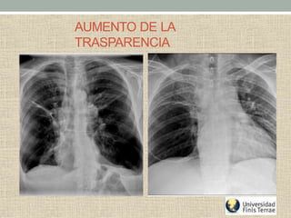 AUMENTO DE LA
TRASPARENCIA
 