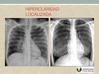 HIPERCLARIDAD
LOCALIZADA
 