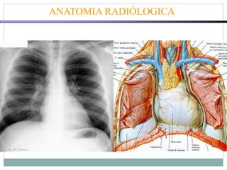 ANATOMIA RADIÓLOGICA
 