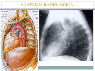 ANATOMIA RADIÓLOGICA
 