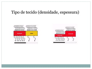 Tipo de tecido (densidade, espessura)
 
