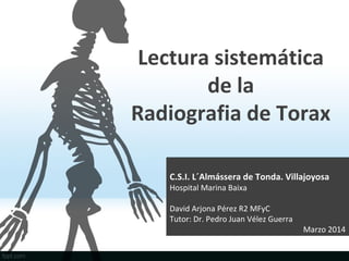 Lectura sistemática
de la
Radiografia de Torax
C.S.I. L´Almássera de Tonda. Villajoyosa
Hospital Marina Baixa
David Arjona...