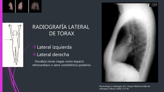 RADIOGRAFÍA LATERAL
DE TORAX
Lateral izquierda
Lateral derecha
Visualiza zonas ciegas como espacio
retrocardiaco o seno costofrénico posterior.
Neumología y radiología, M.C. Gaspar Alberto,Anales de
radiolgoia, Mexico 2008; 1:27-40
 