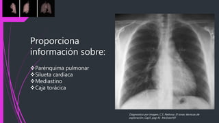 Proporciona
información sobre:
Parénquima pulmonar
Silueta cardiaca
Mediastino
Caja torácica
Diagnostico por imagen, C.S. Pedrosa. El torax: técnicas de
exploración. Cap5. pag 41 McGrawHill
 