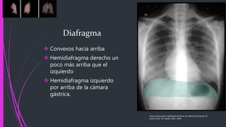  Convexos hacia arriba
 Hemidiafragma derecho un
poco más arriba que el
izquierdo
 Hemidiafragma izquierdo
por arriba de la cámara
gástrica.
Guía practica para radiología de tórax en atención primaria, Dr.
Carlos M.M. Ed. Adalia. Peru. 2005
Diafragma
 