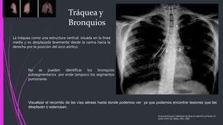 Tráquea y
Bronquios
La tráquea como una estructura vertical, situada en la línea
media y es desplazada levemente desde la carina hacia la
derecha por la posición del arco aórtico.
No se pueden identificar los bronquios
subsegmentarios por ende tampoco los segmentos
pumonares.
Visualizar el recorrido de las vías aéreas hasta donde podemos ver ya que podemos encontrar lesiones que las
desplazen o estenosan.
Guía practica para radiología de tórax en atención primaria, Dr.
Carlos M.M. Ed. Adalia. Peru. 2005
 