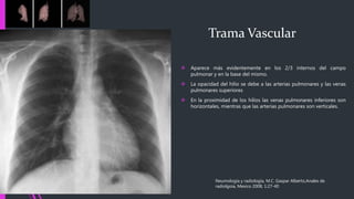  Aparece más evidentemente en los 2/3 internos del campo
pulmonar y en la base del mismo.
 La opacidad del hilio se debe a las arterias pulmonares y las venas
pulmonares superiores
 En la proximidad de los hilios las venas pulmonares inferiores son
horizontales, mientras que las arterias pulmonares son verticales.
Neumología y radiología, M.C. Gaspar Alberto,Anales de
radiolgoia, Mexico 2008; 1:27-40
Trama Vascular
 