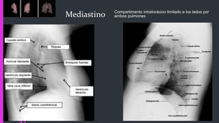 Mediastino Compartimento intratorácico limitado a los lados por
ambos pulmones
 