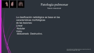 Patología pulmonar
Patrón intersticial
La clasificación radiológica se basa en las
características morfológicas
de las lesiones:
Lineal
Nodular
Vidrio
deslustrado Destructivo.
Guía practica para radiología de tórax en atención primaria, Dr.
Carlos M.M. Ed. Adalia. Peru. 2005
 
