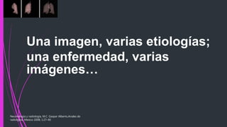 Una imagen, varias etiologías;
una enfermedad, varias
imágenes…
Neumología y radiología, M.C. Gaspar Alberto,Anales de
radiolgoia, Mexico 2008; 1:27-40
 