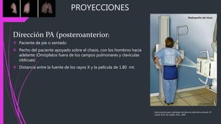 PROYECCIONES
Dirección PA (posteroanterior)
 Paciente de pie o sentado
 Pecho del paciente apoyado sobre el chasis, con los hombros hacia
adelante (Omóplatos fuera de los campos pulmonares y clavículas
oblicuas)
 Distancia entre la fuente de los rayos X y la película de 1.80 mt.
Guía practica para radiología de tórax en atención primaria, Dr.
Carlos M.M. Ed. Adalia. Peru. 2005
 