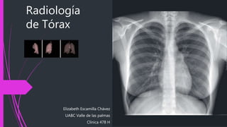 Radiología
de Tórax
Elizabeth Escamilla Chávez
UABC Valle de las palmas
Clínica 478 H
 