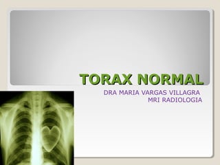 TORAX NORMALTORAX NORMAL
DRA MARIA VARGAS VILLAGRA
MRI RADIOLOGIA
 