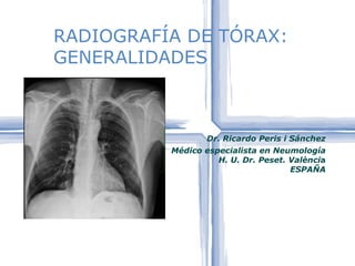 RADIOGRAFÍA DE TÓRAX:
GENERALIDADES



                  Dr. Ricardo Peris i Sánchez
          Médico especialista en Neumología
                    H. U. Dr. Peset. València
                                     ESPAÑA
 