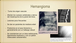 Hemangioma
Tumor de origen vascular.
Afectan los cuerpos vertebrales o deriva
del mesénquima de la pared del tórax.
Lesiones poco frecuentes
Se dan en pacientes de mediana edad
Predomina en el sexo femenino y
generalmente son un hallazgo casual
Se caracterizan por un área radiolucente,
ligeramente expansivo y con un patrón
trabeculado característico.
 