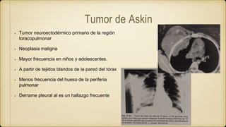 Tumor de Askin
Tumor neuroectodérmico primario de la región
toracopulmonar
Neoplasia maligna
Mayor frecuencia en niños y adolescentes.
A partir de tejidos blandos de la pared del tórax
Menos frecuencia del hueso de la periferia
pulmonar
Derrame pleural al es un hallazgo frecuente
 