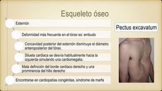 Esqueleto óseo
Esternón
Deformidad más frecuente en el tórax es: embudo
Concavidad posterior del esternón disminuye el diámetro
anteroposterior del tórax.
Silueta cardiaca se desvía habitualmente hacia la
izquierda simulando una cardiomegalia.
Mala definición del borde cardiaco derecho y una
prominencia del hilio derecho
Encontrarse en cardiopatías congénitas, síndrome de marfa
Pectus excavatum
 