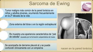 Sarcoma de Ewing
Tumor maligno más común de la pared torácica en
niños y adultos jóvenes, ocurriendo frecuentemente
en la 2º década de la vida
Zona externa del tórax o en la región extrapleural
Rx muestra una apariencia característica de “piel
de cebolla” causada por la formación subperióstica de hueso
Se acompaña de derrame pleural al y se puede
confundir clínicamente con un empiema nacen en la pared torácica
 