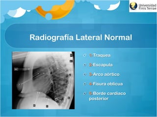Radiografía Lateral Normal
!   1-Traquea
!   2-Escapula
!   3-Arco aórtico
!   4-Fisura oblicua
!   5-Borde cardiaco
posterior
 