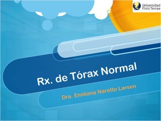 Rx. de Tórax Normal
Dra. Emiliana Naretto Larsen
 
